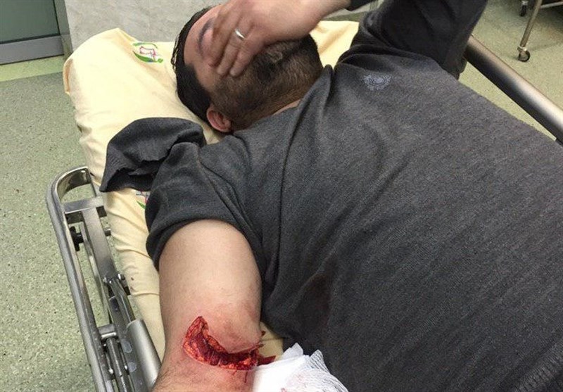 زخمی شدن دو بسیجی در تعقیب و گریز با سارقین در تهران / عکس18+