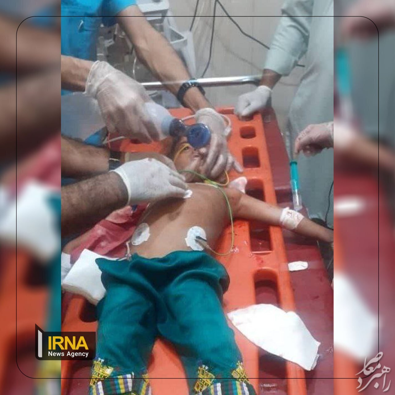 عکس | کودک مجروح‌شده در حملات تروریستی گروهک جیش‌الظلم