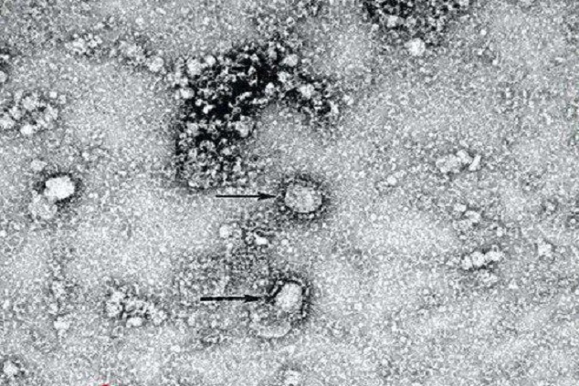 اولین تصویر میکروسکوپی از ویروس کرونا +عکس