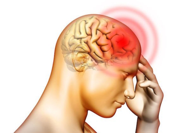 انواع درمان سر درد