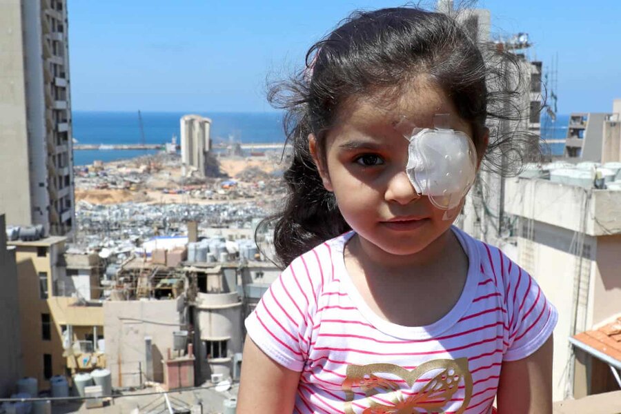 عکس | دخترک مجروح لبنانی