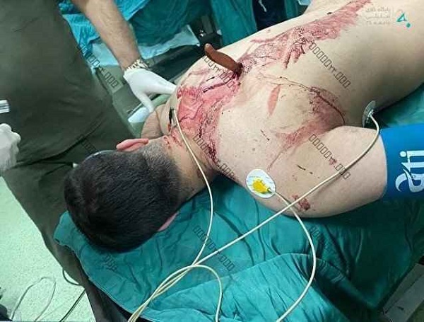 ماجرای حمله با چاقو به پرستار بیمارستان شهدای تجریش+ (عکس ۱۸+)