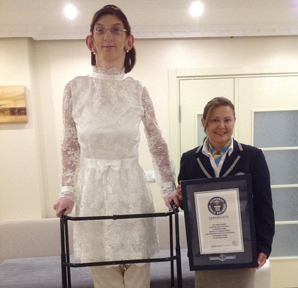 سندروم ویور دختر ترک را بلند قد‌ترین زن جهان کرد+ عکس و فیلم