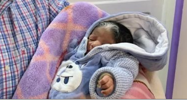 تولد نوزادی بدون پوست و مو سفید در مصر+ عکس