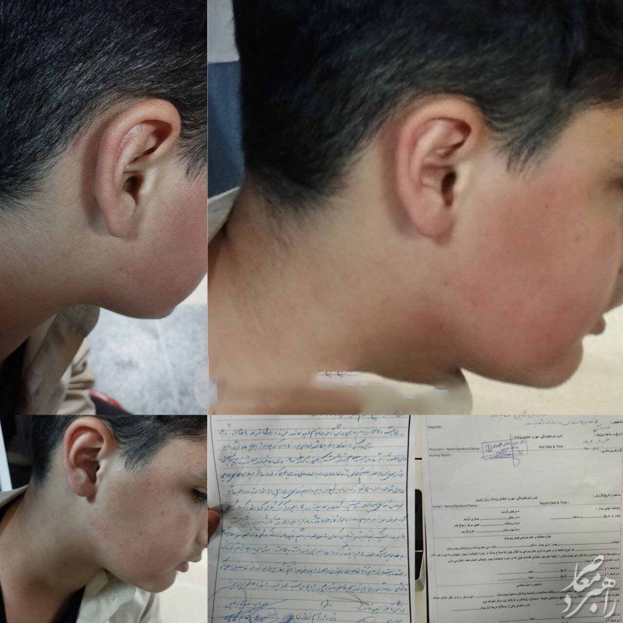 لغو ابلاغ معلم خاطی در پی تنبیه بدنی دانش آموز لاهیجانی + عکس