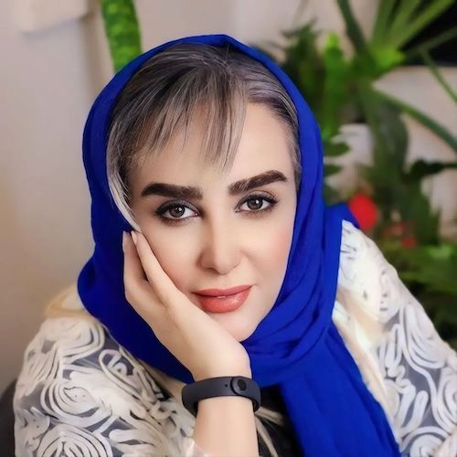 تغییر چهره عجیب این بازیگر ایرانی سوژه شد + عکس