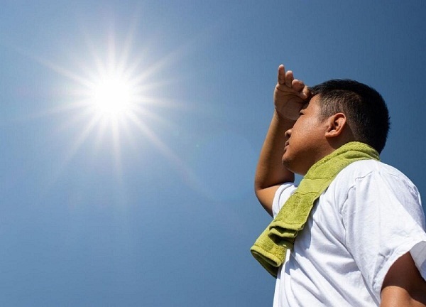 کارهایی که باید برای جلوگیری از آفتاب‌ سوختگی انجام دهید