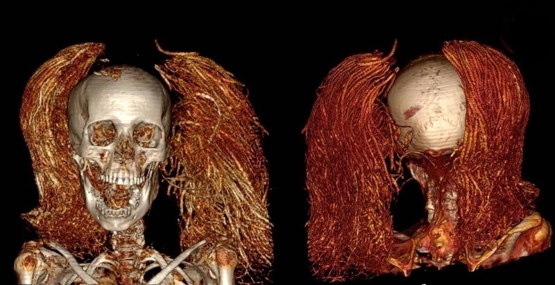 راز‌ زن مومیایی که ۳۵۰۰ سال در حالت جیغ مانده است + تصاویر