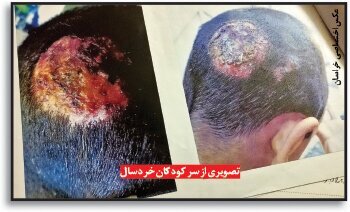 جنایت‌های مرد قصاب در مشهد | از فروش گوشت الاغ تا کودک‌ آزاری فجیع + عکس
