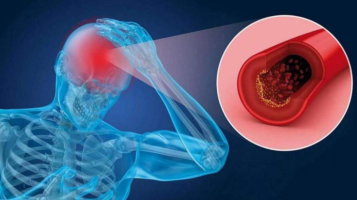 کدام مواد غذایی خون را غلیظ می‌کند؟