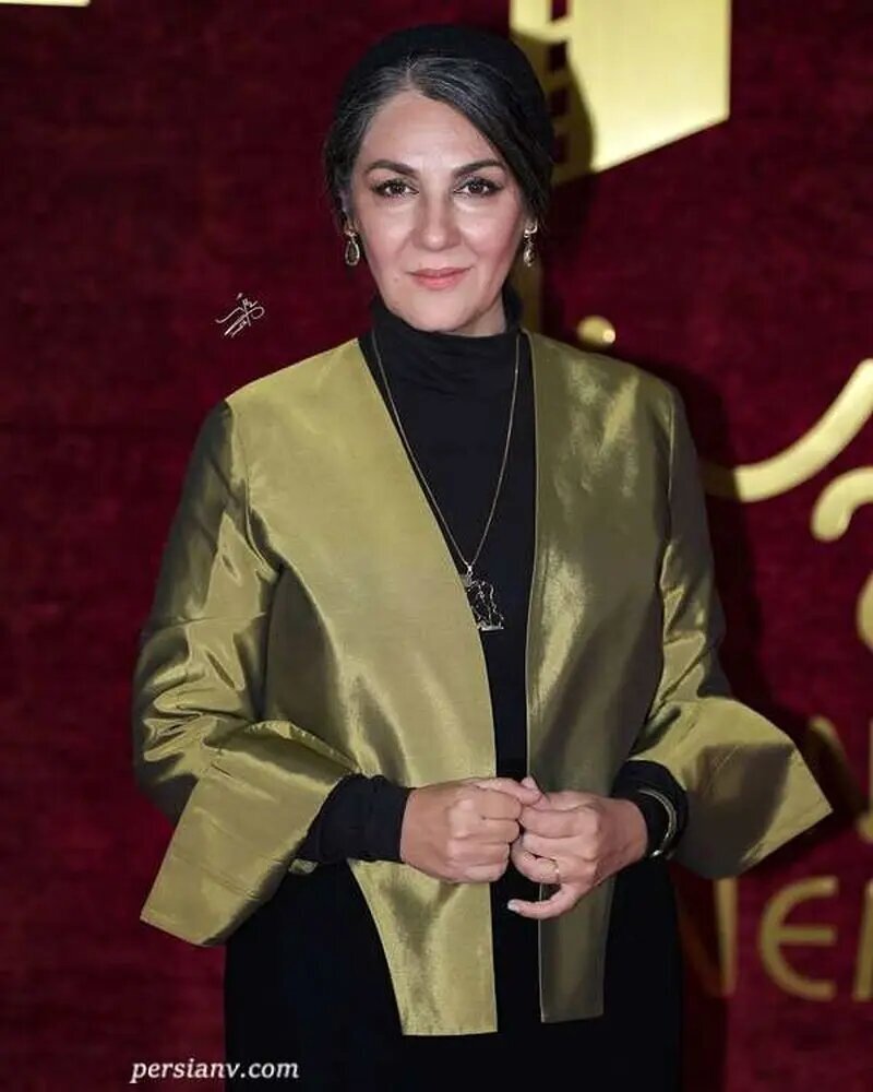 تغییر چهره ستاره اسکندری، بازیگر جانشین پوپک گلدره در سریال «نرگس» بعد از ۱۹ سال + عکس