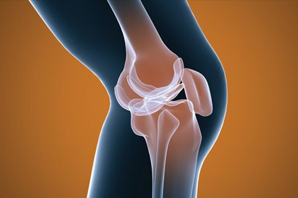 این علائم نشانه آرتروز است