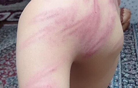 معلم خاطی کردستانی به دلیل تنبیه بدنی دانش‌آموزان اخراج شد