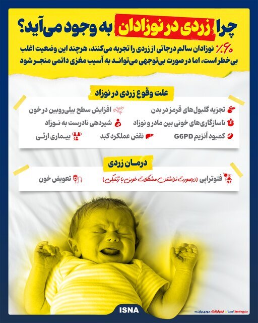 اینفوگرافیک/ چرا زردی در نوزادان به وجود می‌آید؟