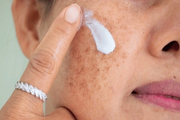 توصیه‌های طب سنتی برای حفظ سلامت پوست در تابستان