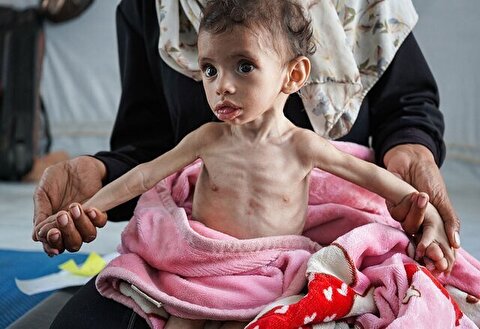 سازمان ملل: سوء تغذیه حاد در کودکان غزه به بالاترین سطح خود رسیده است