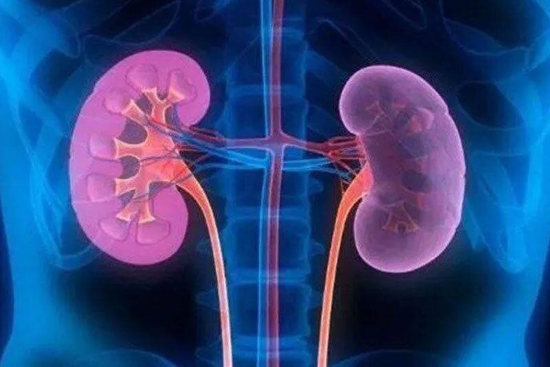 مشروبات الکلی سنگ کلیه را درمان می‌کند؟