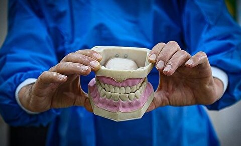 رئیس انجمن دندانسازی: بیمه‌ها پوشش کامل خدمات ما را ندارند