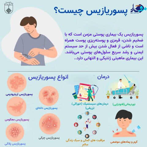 اینفوگرافیک / هشدار درباره یک بیماری پوستی شایع + علائم و راه‌های کنترل