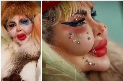 فیلم / این زن ایرانی با ۳۸۸ عمل رکوردار جراحی زیبایی در گینس است