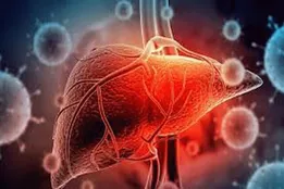 کبد چرب را با این اقدامات کنترل کنید