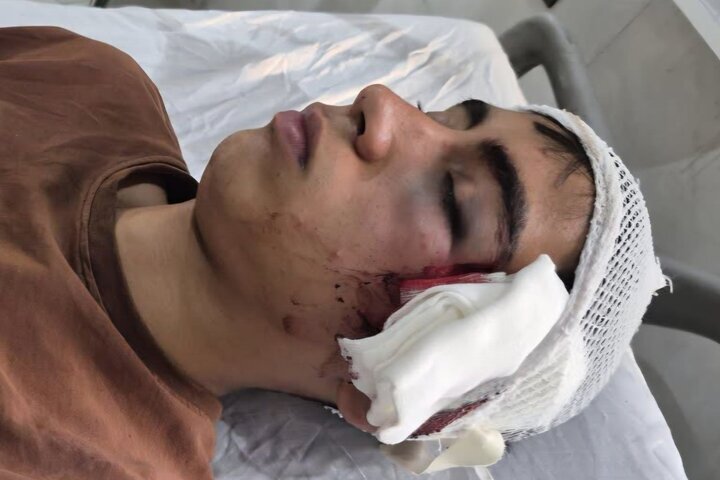 ضرب‌وشتم دانش‌آموز با دسته صندلی / روایت پدر از خشونت علیه فرزندش در دبیرستان دهبکری بم / آموزش‌وپرورش وعده پیگیری داد + عکس