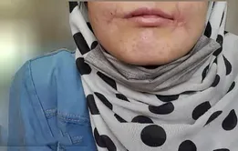 مرد مشهدی لب‌های زن ۱۸ ساله‌اش را دوخت / فائزه به کلانتری پناه برد + عکس