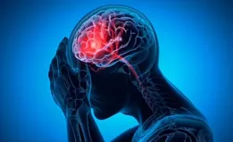 پیش‌بینی احتمال سکته مغزی با هوش مصنوعی